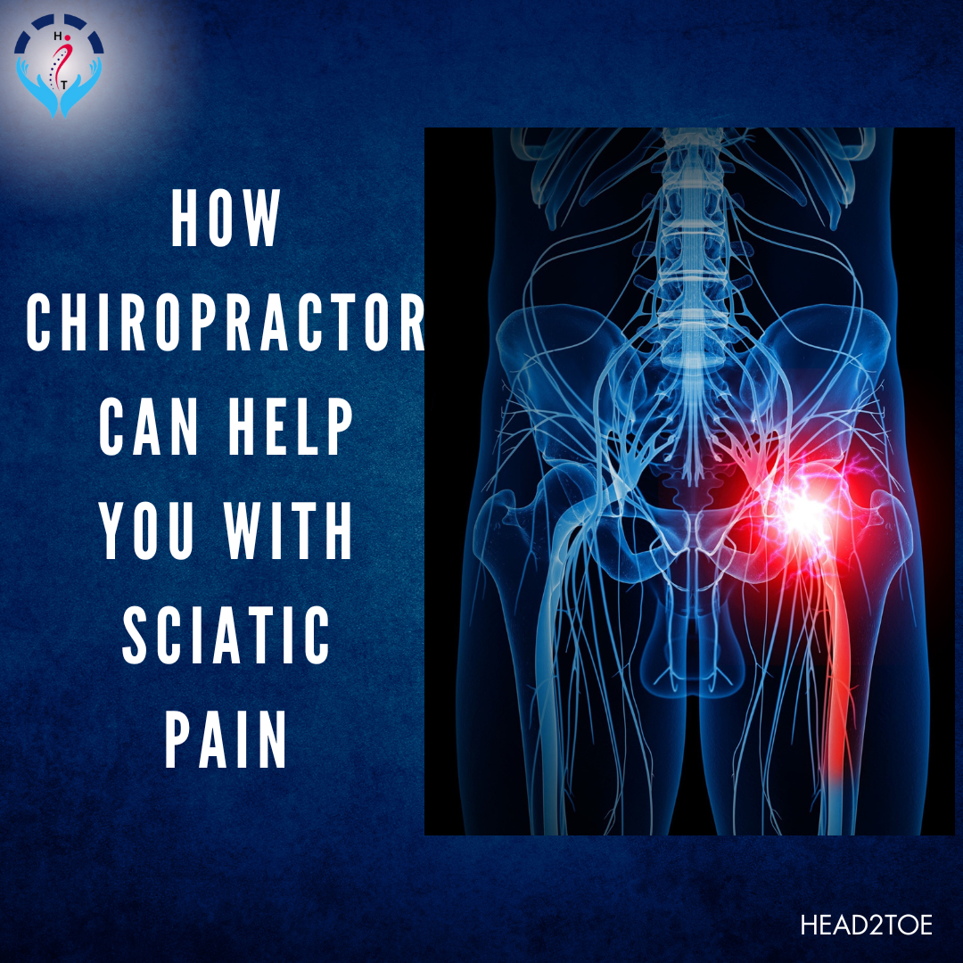 BLOG-SCIATIC-PAIN-4.png