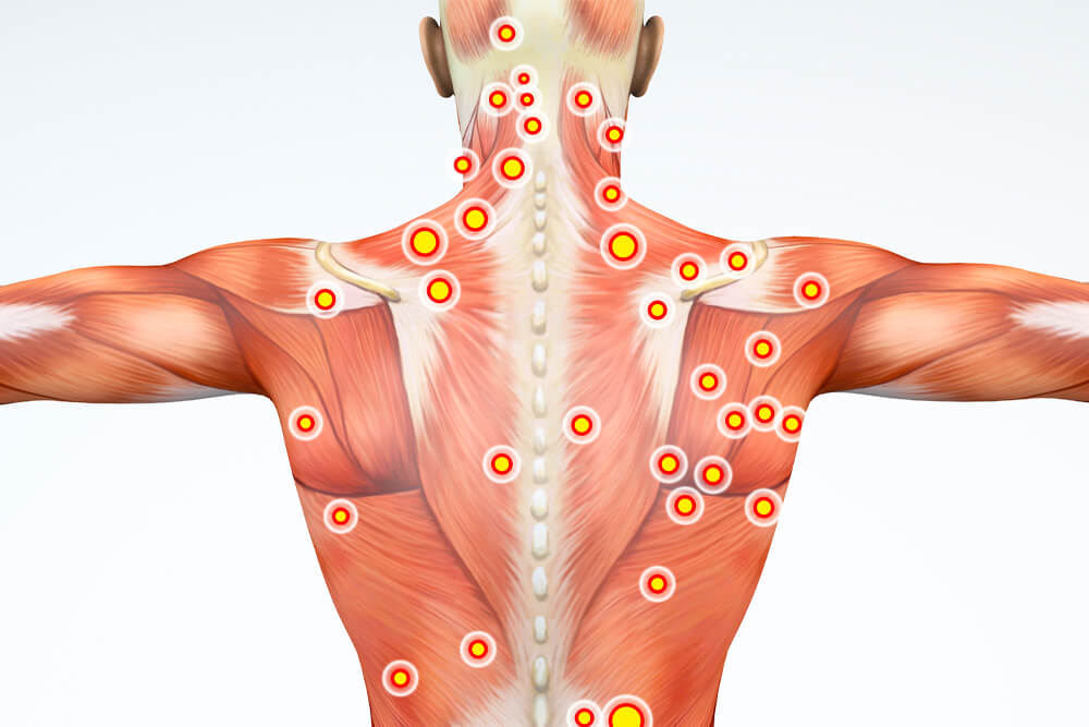 CervicogenicBlog-8.jpg